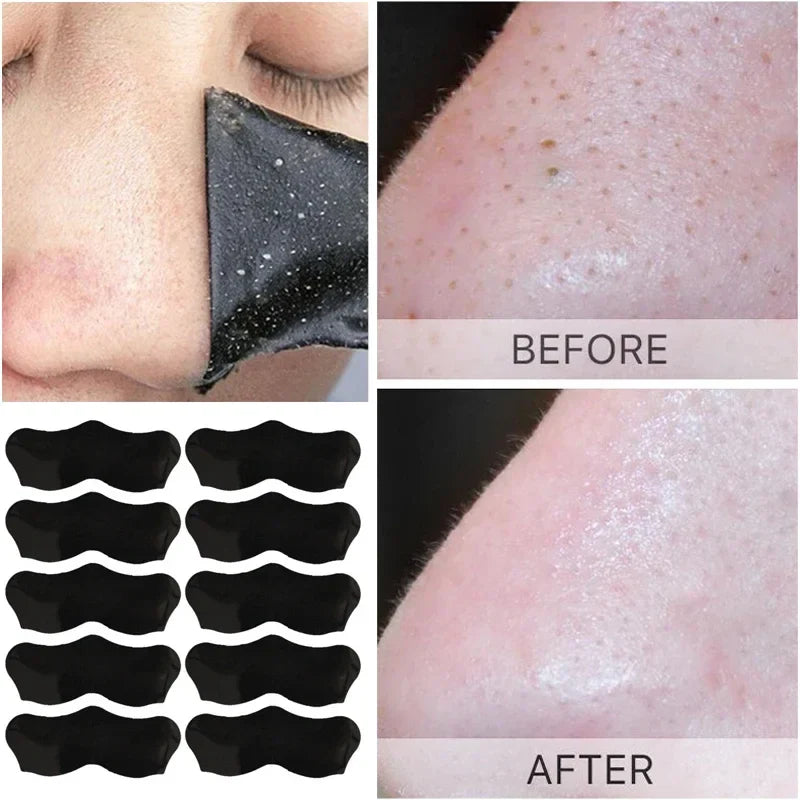 Patch anti-points noirs