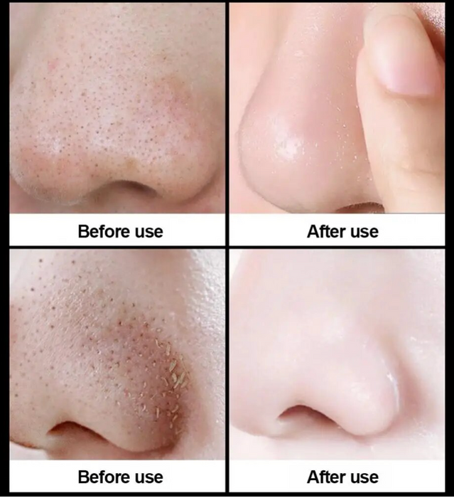 Facial Mask Skin Care