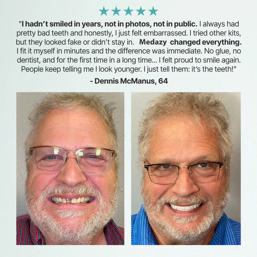 Advanced Custom-Fit Functional Dentures 🦷 Smile Confidently Again in Just 3 Minutes No Dentist Needed! (2)